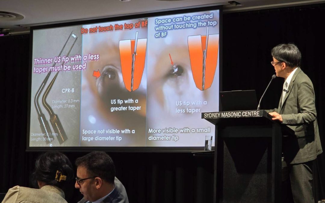 DR YOSHI TERAUCHI – Endodontic Retreatment and File Removal